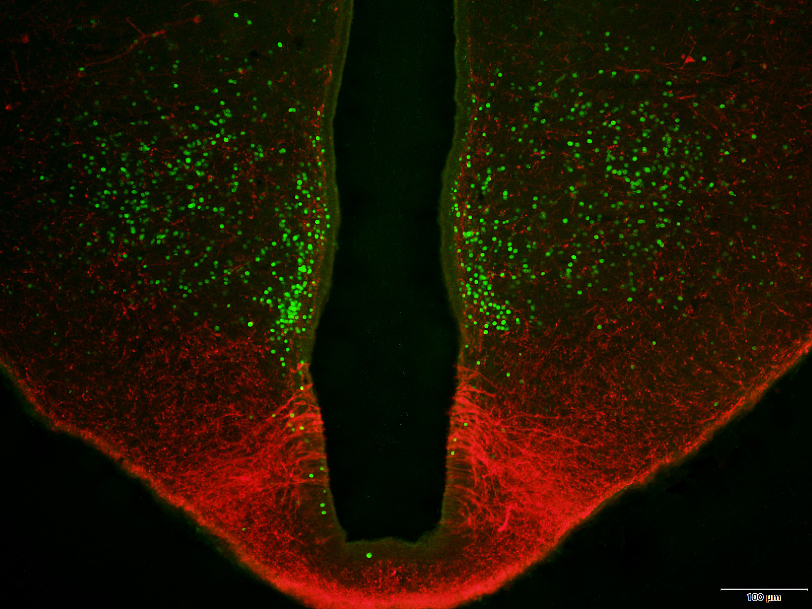 Expression of SATB1 and SATB2 in the brain of bony fishes: what fish reveal about evolution